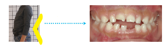 姿勢と噛み合わせのつながり